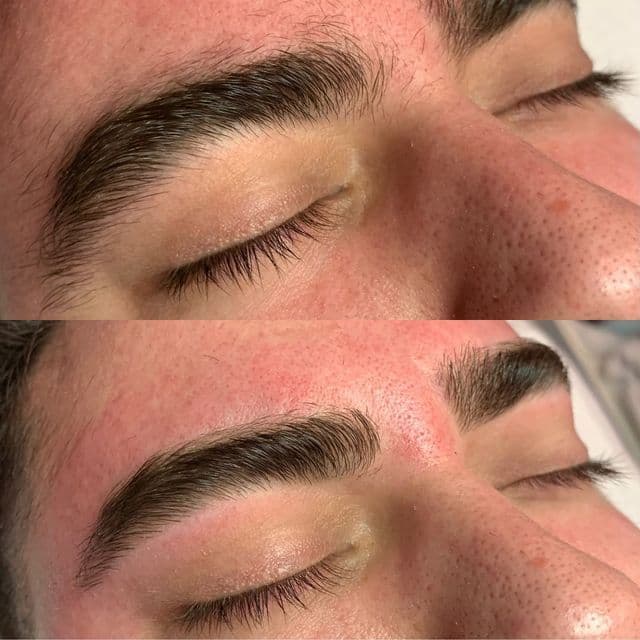 Hairline 1