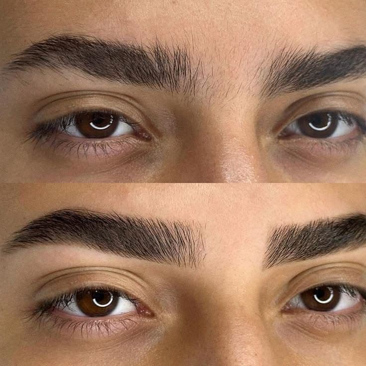 Hairline 2