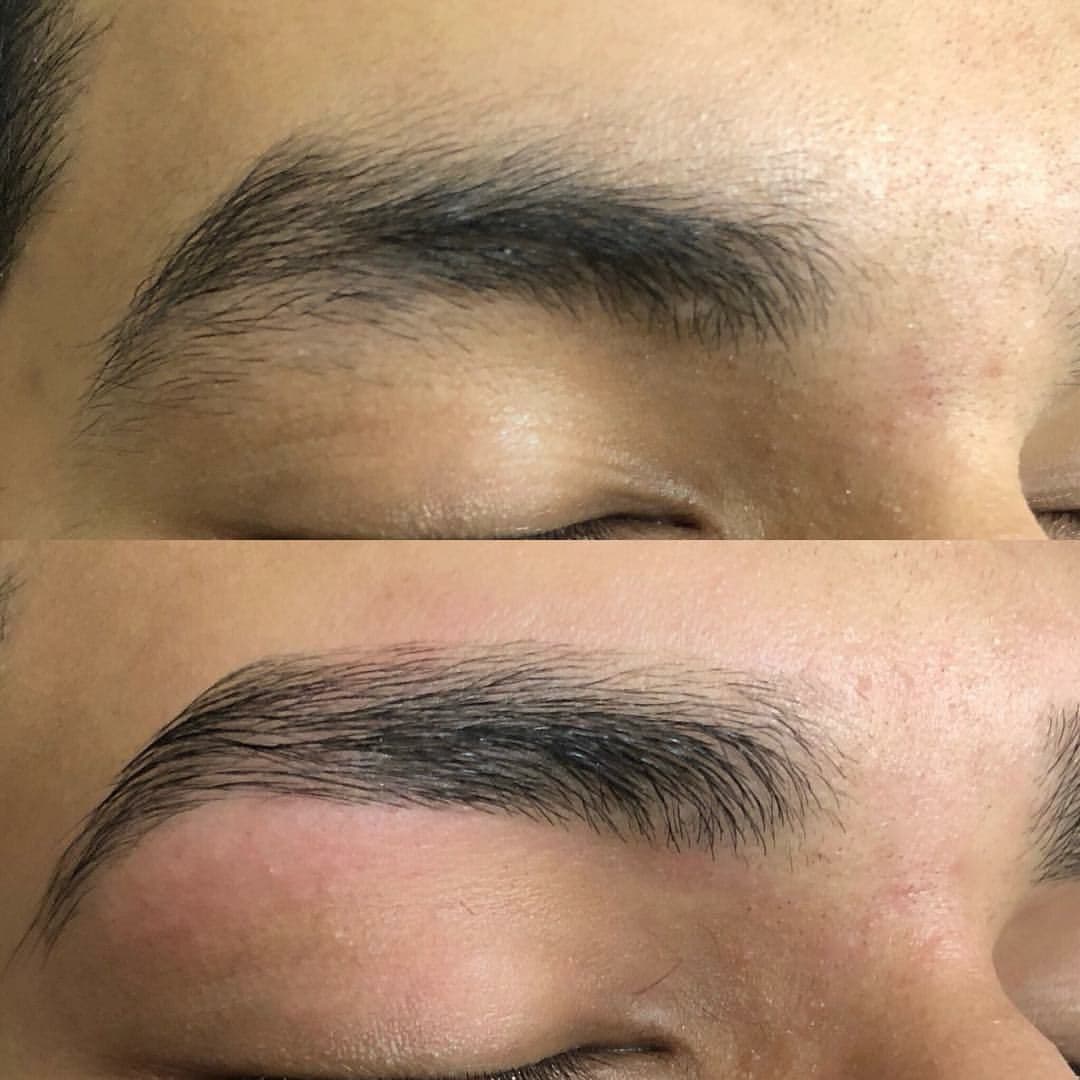 Hairline 3
