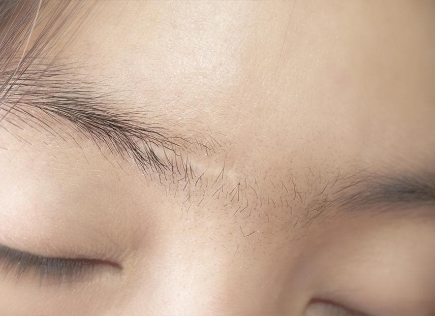 Eyebrow Scars? Here's How to Cover Them Naturally